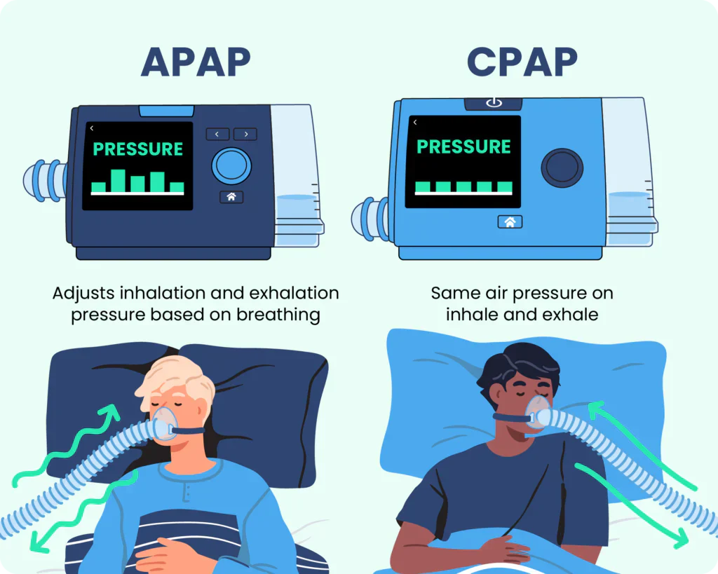 Fixed Pressure vs Auto Pressure CPAP Machines: What’s the Difference?