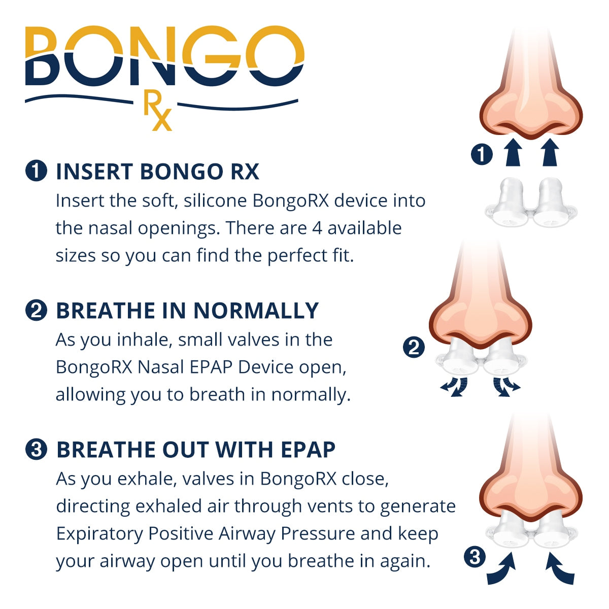 Bongo Rx EPAP Therapy Device Starter Kit - Easy CPAP